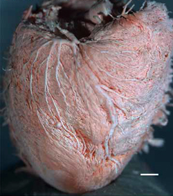Heart